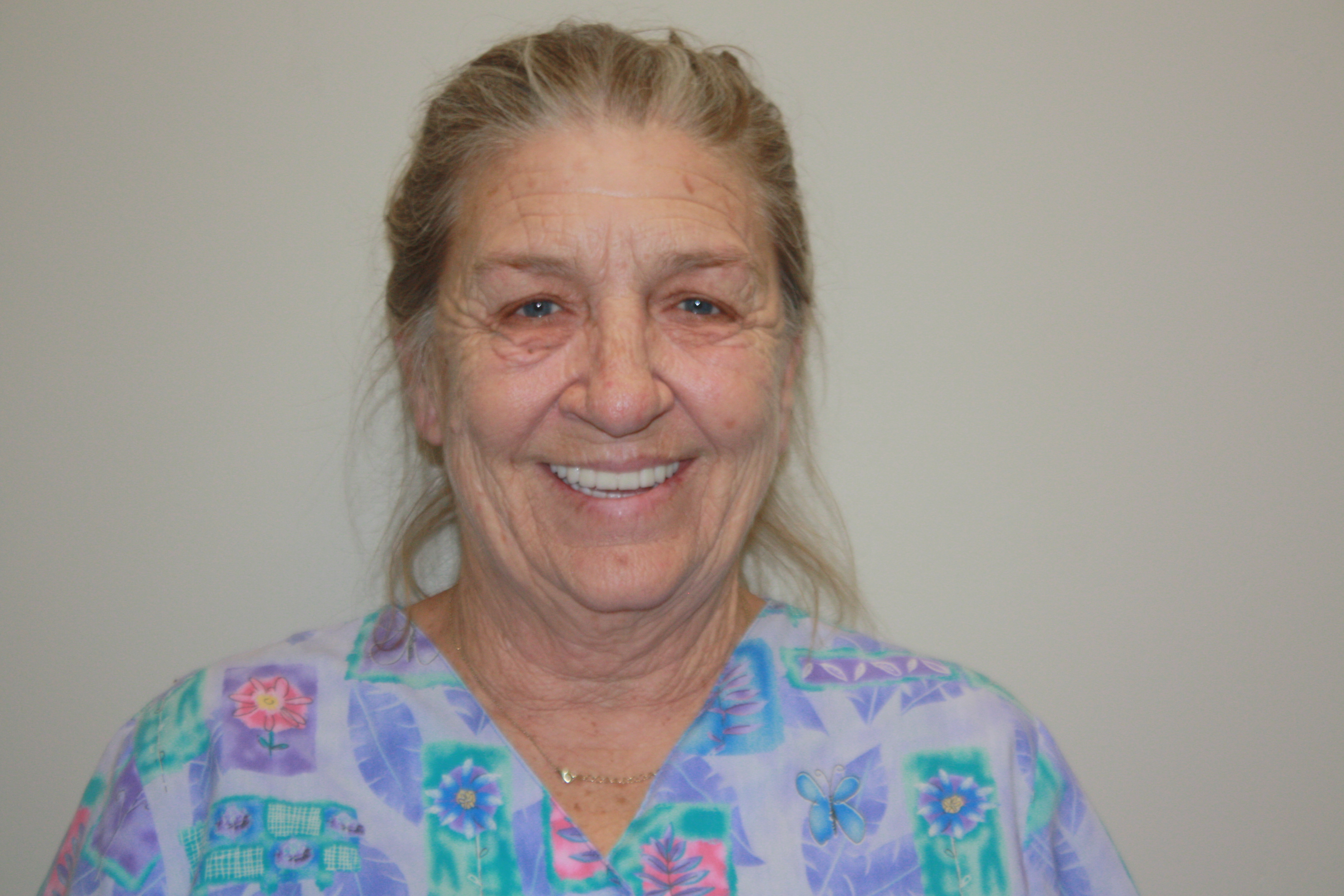 After photo of Bridgette's cosmetic dental treatment at North County Cosmetic and Implant Dentistry in Vista, CA