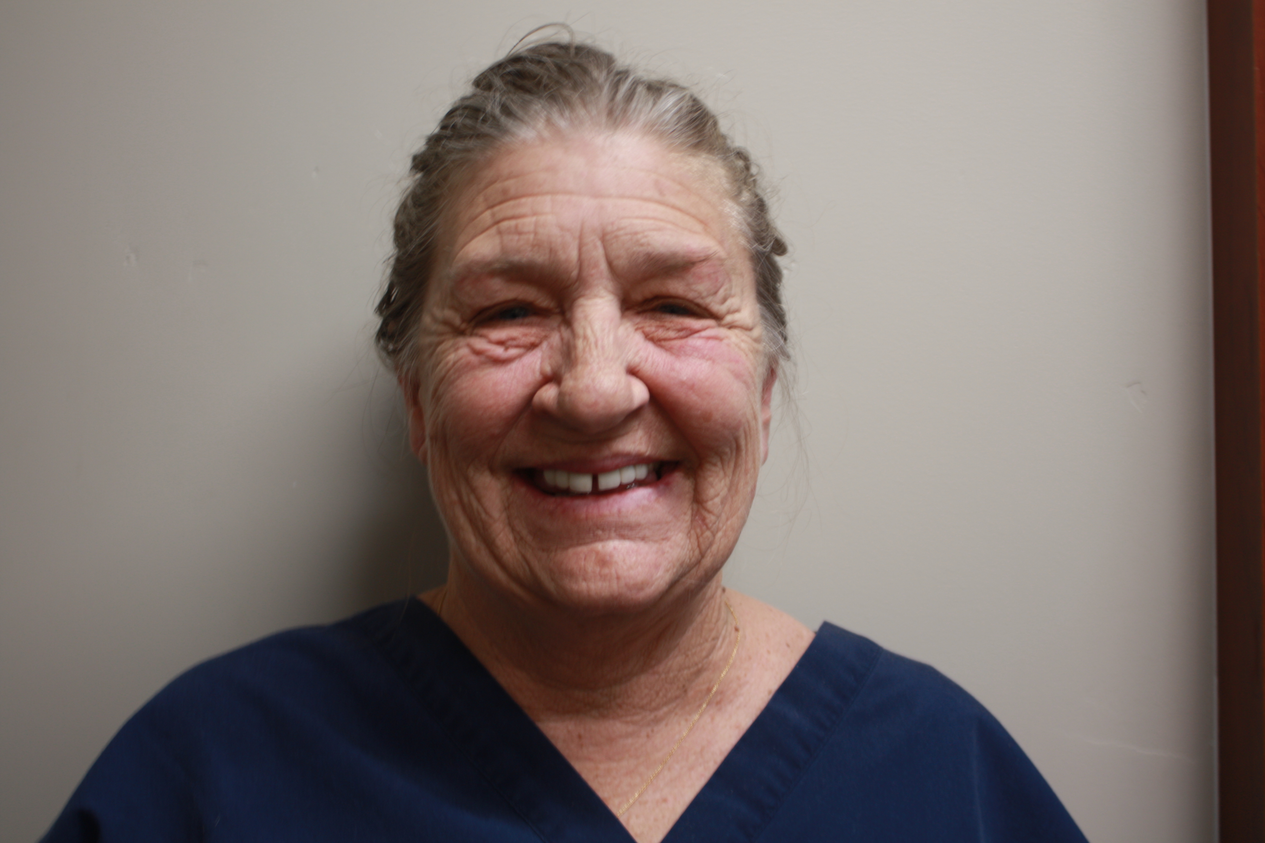 Before photo of Bridgette's smile makeover at North County Cosmetic and Implant Dentistry in Vista, CA