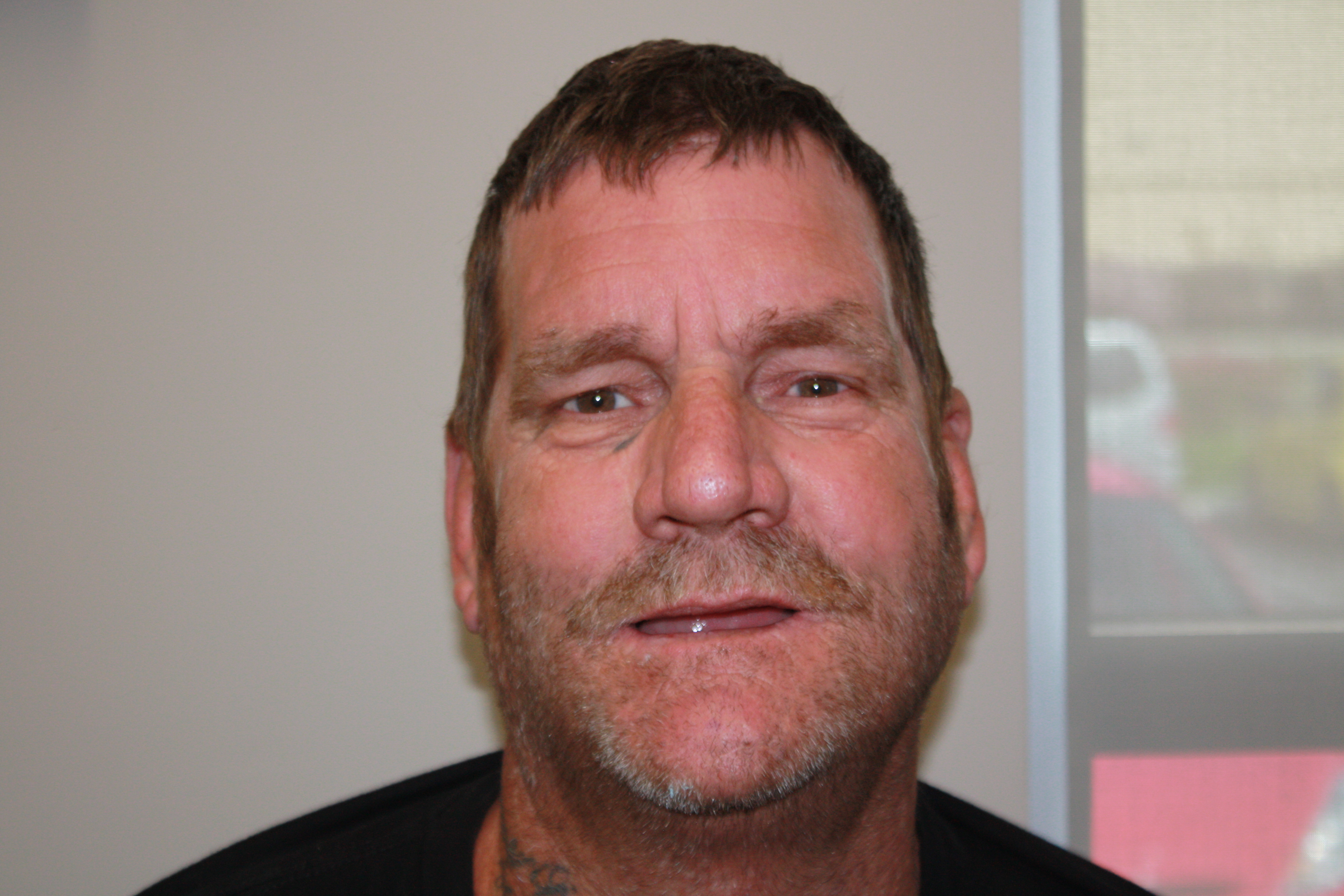 Before photo of Craig's dental treatment at North County Cosmetic and Implant Dentistry in Vista, CA