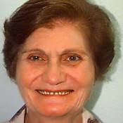 Before photo of dentures treatment at North County Cosmetic and Implant Dentistry in Vista, CA