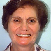 After photo of dentures at North County Cosmetic and Implant Dentistry in Vista, CA