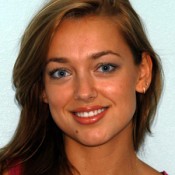Before photo of Helena’s dental transformation at North County Cosmetic and Implant Dentistry in Vista, CA
