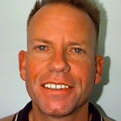 Before photo of Mark’s dental transformation at North County Cosmetic and Implant Dentistry in Vista, CA