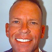 After photo of Mark’s dental restoration at North County Cosmetic and Implant Dentistry in Vista, CA