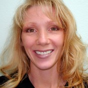 After photo of smile rejuvenation treatment at North County Cosmetic and Implant Dentistry in Vista, CA