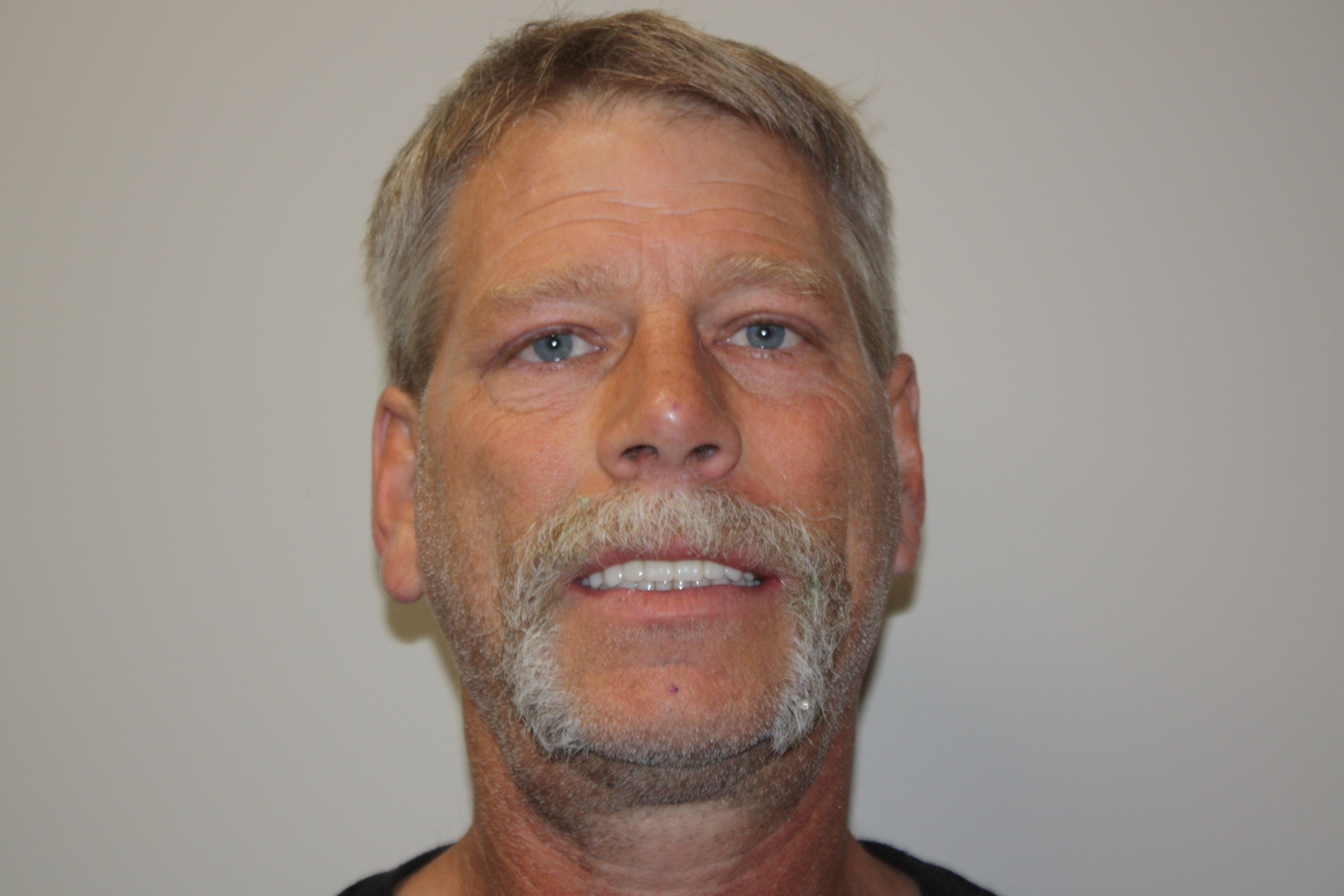 After photo of Terry's smile restoration at North County Cosmetic and Implant Dentistry in Vista, CA