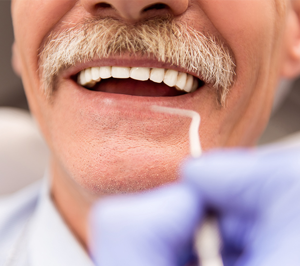 Vista Adjusting to New Dentures
