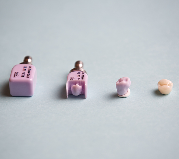 Vista Dental Crowns and Dental Bridges