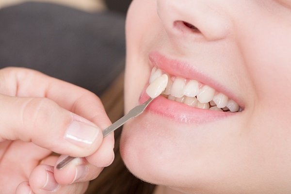 Can Dental Veneers Ruin The Teeth?