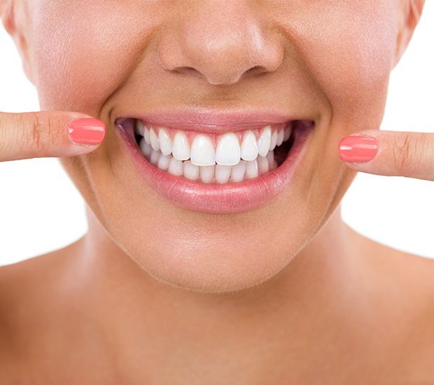 Vista What Is Gum Contouring & Reshaping