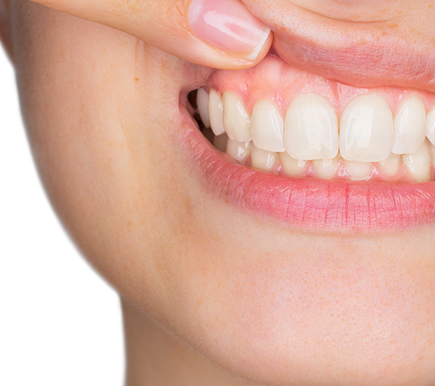 Vista Gum Disease