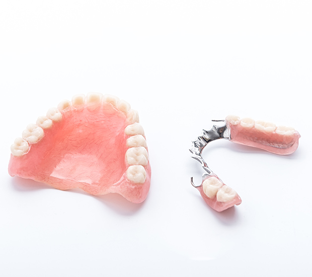 Vista Partial Dentures for Back Teeth