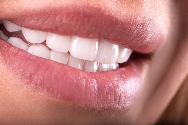 Benefits Of A Smile Makeover