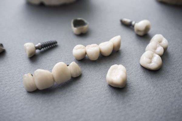 Types of Dental Implants from North County Cosmetic and Implant Dentistry in Vista, CA