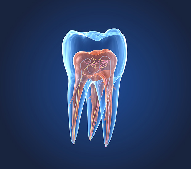Vista What is an Endodontist